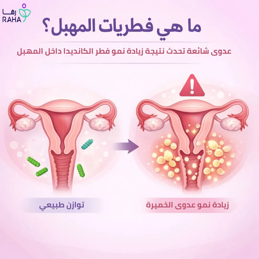 ما هي فطريات المهبل؟